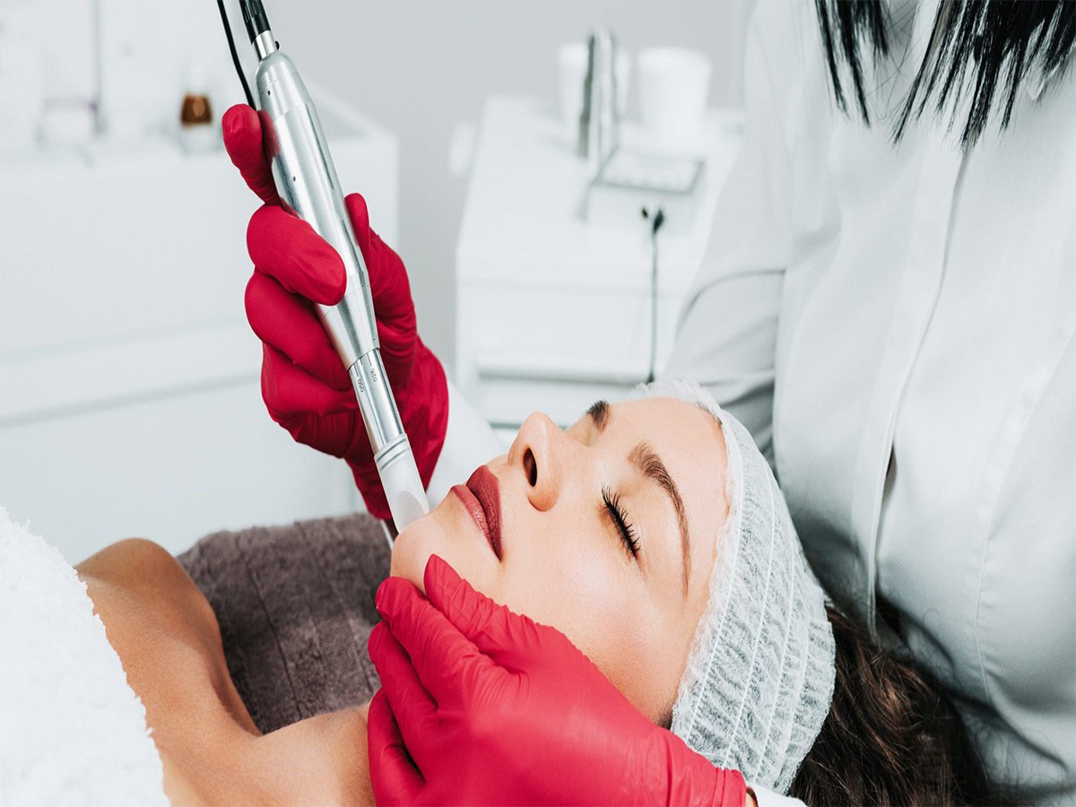 Microneedling