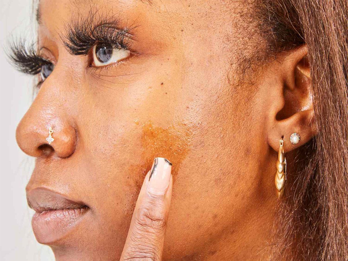 Dark Spots