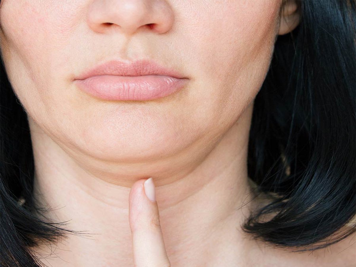 Double Chin Treatment