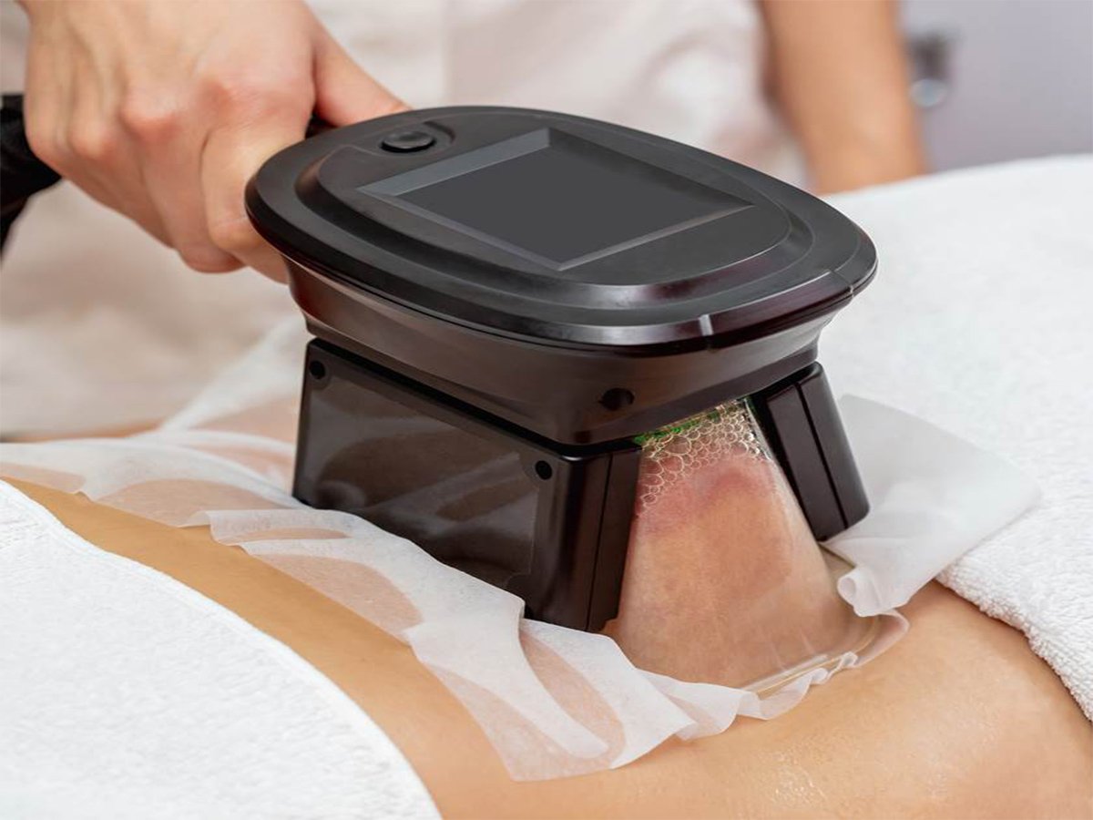 Fat Freezing