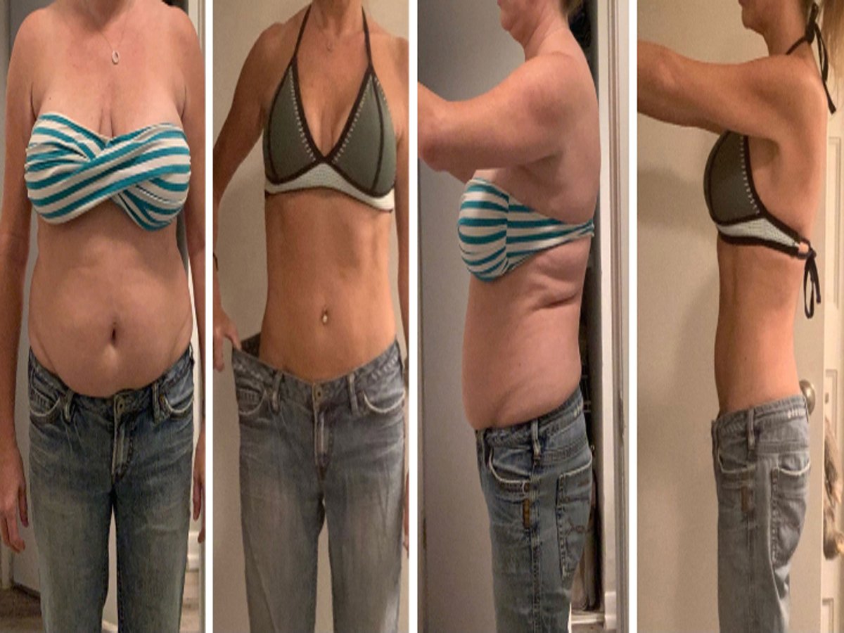 Simaglutide Weight Loss